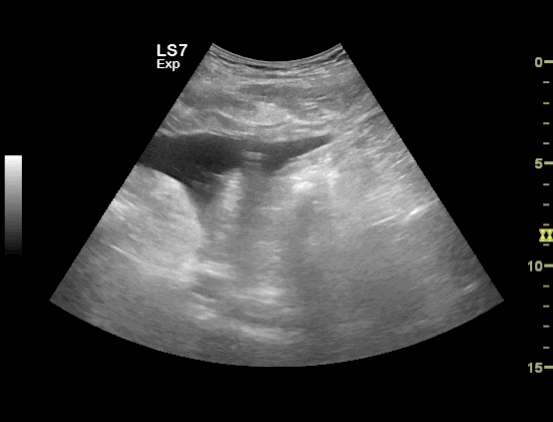 EEU case image missing